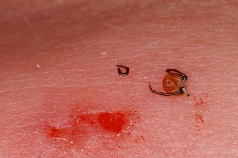Ixodes_ricinus_D5040_Z_89_Les Gris_Frankrijk.jpg
